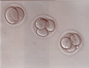 2-cell-and-4-cell-embryos-2-days-after-retrieval